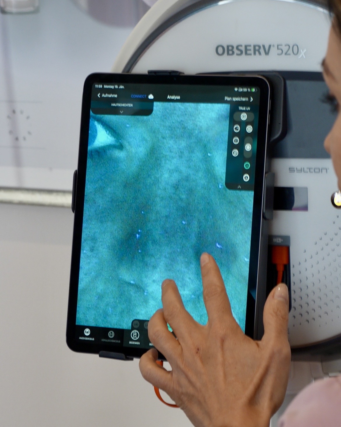 Tablet am Observ 520x zeigt die UV-Analyse der Haut bei derma_glow