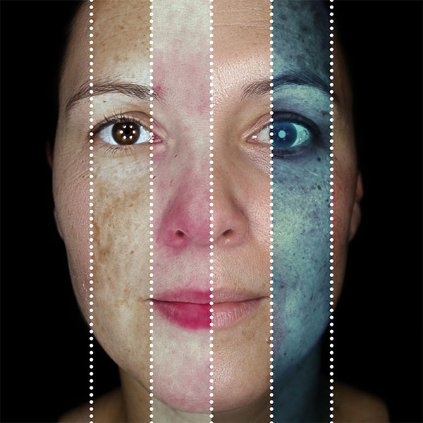 Gesicht in vier Analysemodi des Observ 520x: Tageslicht, Pigment, Oberfläche und UV